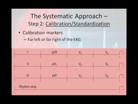 12 Lead Interpretation Part 2: The 6 Step 12-Lead Interpretation Process