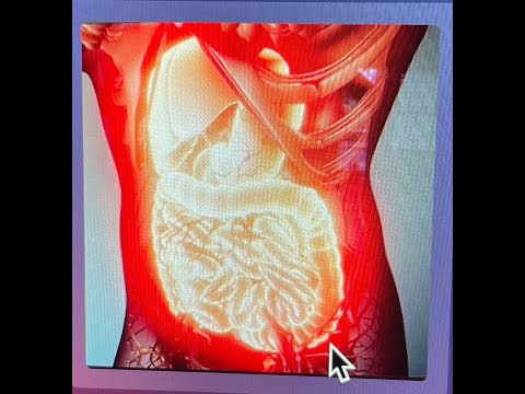 Do you have 'Metaflammation'?