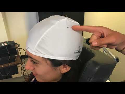 Transcranial Magnetic Stimulation (TMS)-Finding Resting Motor Threshold