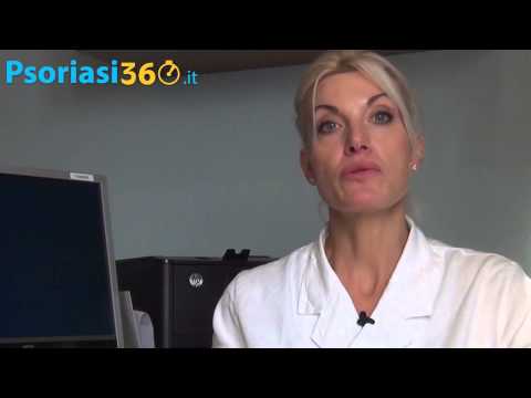 Cura di eczema di dita del piede Trattamento moderno di cura di psoriasi