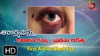 Aarogyamastu | First Aid for Black Eye | 29th May 2017 | ఆరోగ్యమస్తు