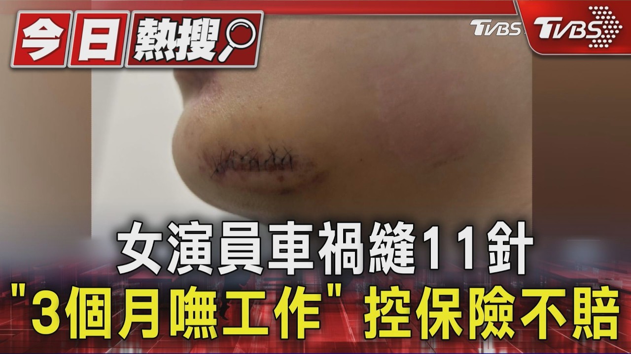 獨家/21歲演員車禍縫11針、牙斷 控保險改口除疤不賠