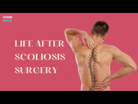 Life After Scoliosis Surgery