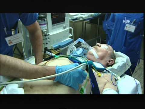 85 Medizin Video Nakose - jeder 2te über 60 wacht verwirt auf NDR Visite.