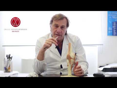 Esercizio in video osteocondrosi fitball Pomata dolori articolari sui suoi piedi