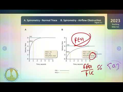 COPD GUIDELINES FOR COPD COMPLETE