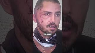 Barely alive After Gator Attack💥