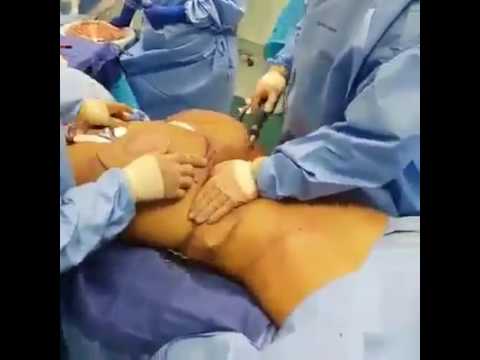 Resep HLS untuk menurunkan berat badan Penurunan berat badan dalam 12 minggu