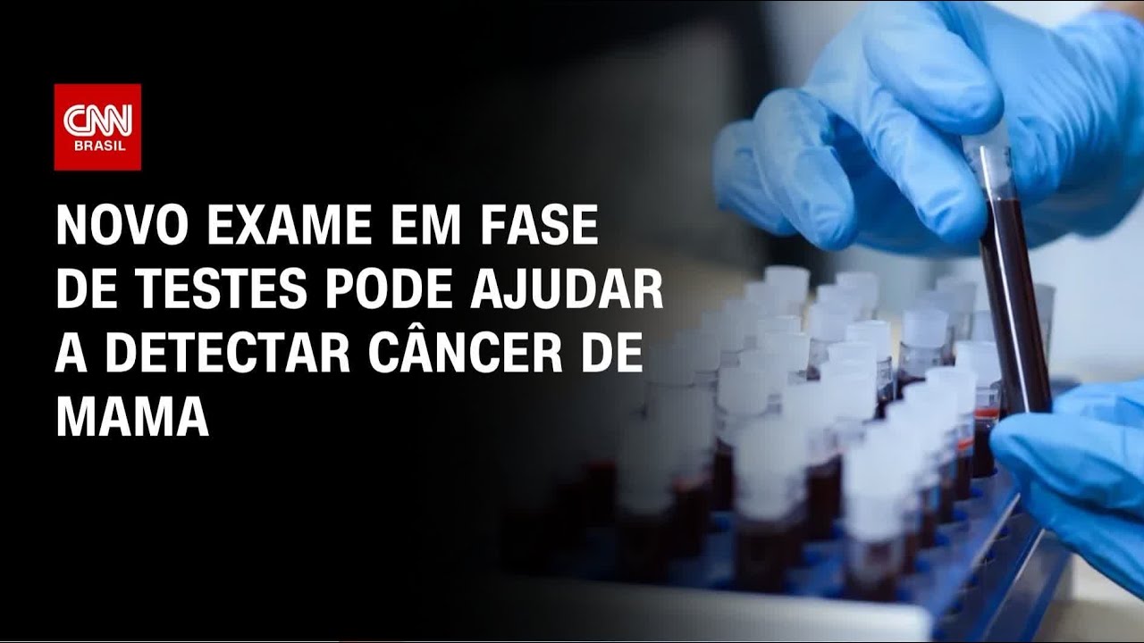 Exame de sangue em teste no Brasil pode ajudar a detectar câncer de mama | CNN PRIME TIME