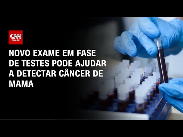 Exame de sangue em teste no Brasil pode ajudar a detectar câncer de mama | CNN PRIME TIME