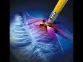 Isochronic Music To Help Ease Chronic Pain Headaches Or Sleep Natural