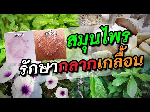 กลากน้ำ กลากแพ้อาหาร