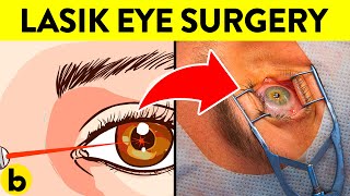 12 Things You Should Know About Laser Eye Surgery & Eye Health (LASIK)