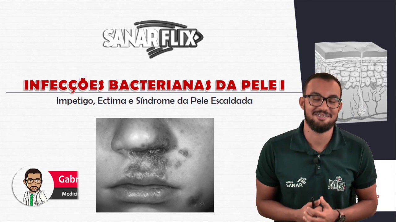 Infecções bacterianas de pele (Parte 1) - Impetigo, ectima e pele escaldada - Aula SanarFlix