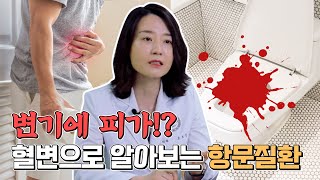[TV] ȭ ⿡ ǰ!? Ȥ ū  ƴұ?  ˾ƺ ׹ȯ!