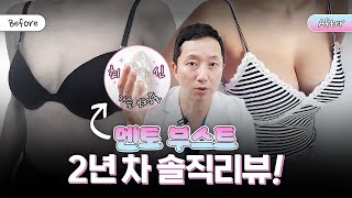 신상 보형물 멘토 부스트 출시 2년 차! 월드클래스 원장님의 솔직 리뷰