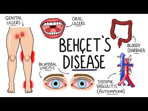 Understanding Wilson s Disease Hepatolenticular Degeneration