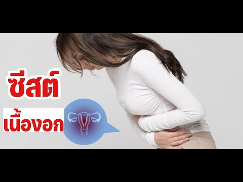 สมาชิกโดยไม่ต้องรบกวนเพิ่มขึ้น ธ อร์ค้อน pepakura สแกน