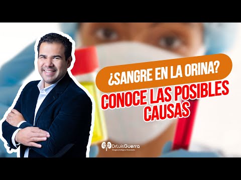 Sangre en la Orina| Conoce sus causas