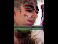 18st gets Hood Tattoo on his Forehead