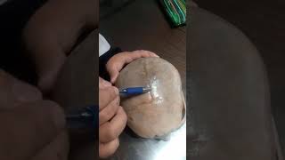 skull calva+sutures