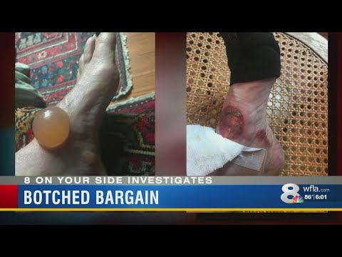 Erupting steamer burns customers, Mangano company sued for not disclosing defect