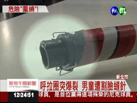 呼拉圈爆裂割臉 男童縫10多針!