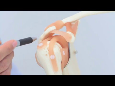 Die Rotatorenmanschette - Funktion und Verletzungen