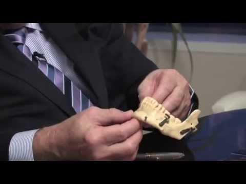 Congenital Hemangioma corrective Cosmetic Surgery by Dr. Michael Eisemann