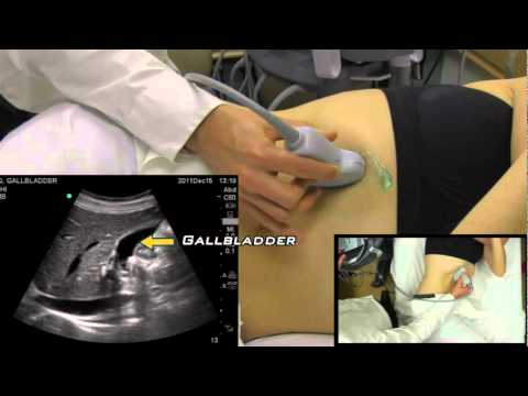 Gallbladder Ultrasound from One Minute Ultrasound