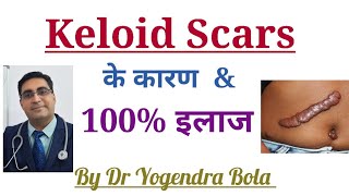 Keloid Scars - के Causes and 100% Treatment Options - By Dr Yogendra Bola