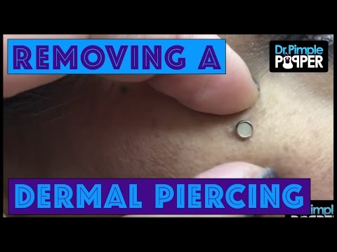 This Dermal Piercing Removal Video Will Make You Rethink Your Next Piercing