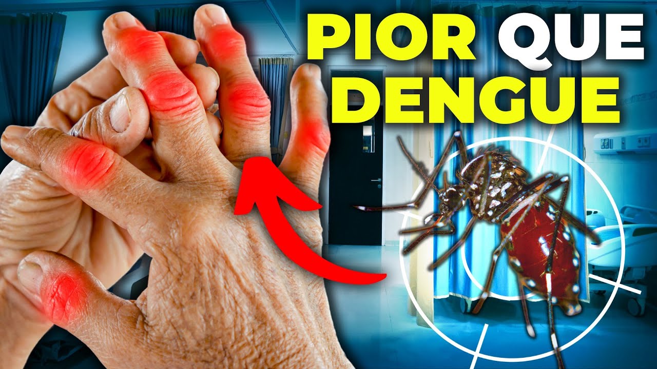 O Vírus IGNORADO Que Está INCAPACITANDO BRASILEIROS por MESES