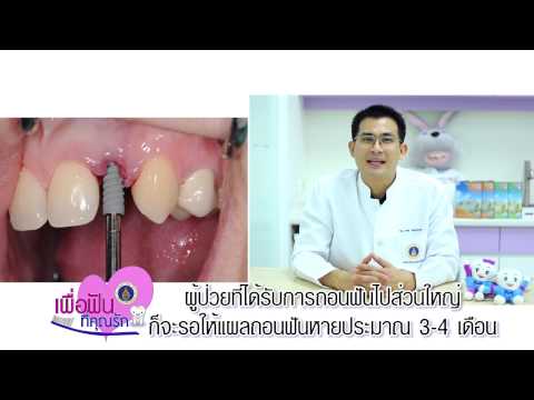 หัวนมขนาดเล็ก 70 การออกกำลังกายสำหรับสาว ๆ ขยายเต้านม