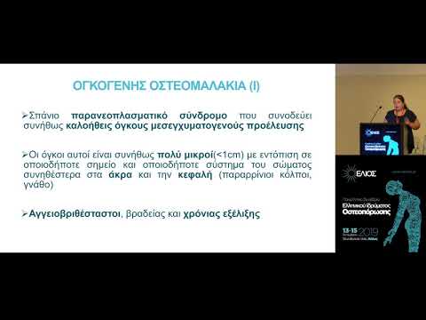 Καπετάνου Α. - Ογκογενής οστεομαλκια - Διαγνωστική και θεραπευτική πρόκληση