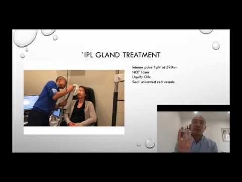 Dry Eye Management for Scleroderma Patients - Jason Teh