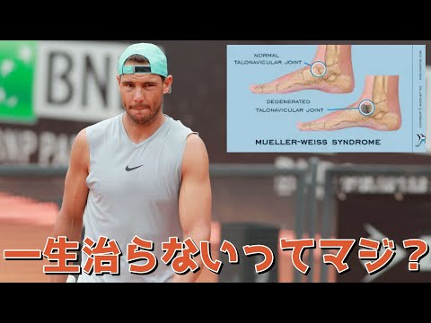 【海外テニス】ナダルの足の怪我「ミュラーワイス病」を知ってる?【全仏オープン間に合うの?】