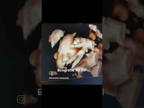 Massimiliano Giardina-8