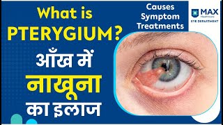 Pterygium Treatment | Best way to remove Pterygium Conjunctival autografting आँख में नाखूना \का इलाज