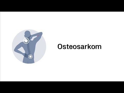 Wie lange die Behandlung Osteochondrose Schmerzen im unteren Rücken im unteren Teil des rechten