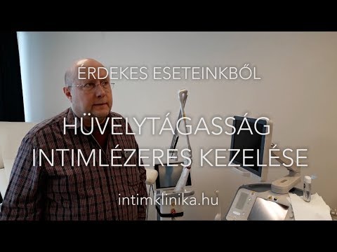 Kerekférgek ahol a természetben élnek