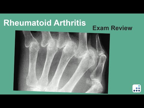 Rheumatoid Arthritis Exam Review - Matthew L. Ramsey, MD