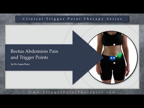 Rectus Abdominis Pain and Trigger Points