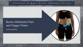 Rectus Abdominis Pain and Trigger Points