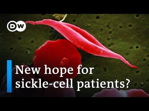 Could gene therapy be a gamechanger in the fight against sickle-cell anemia? | DW News