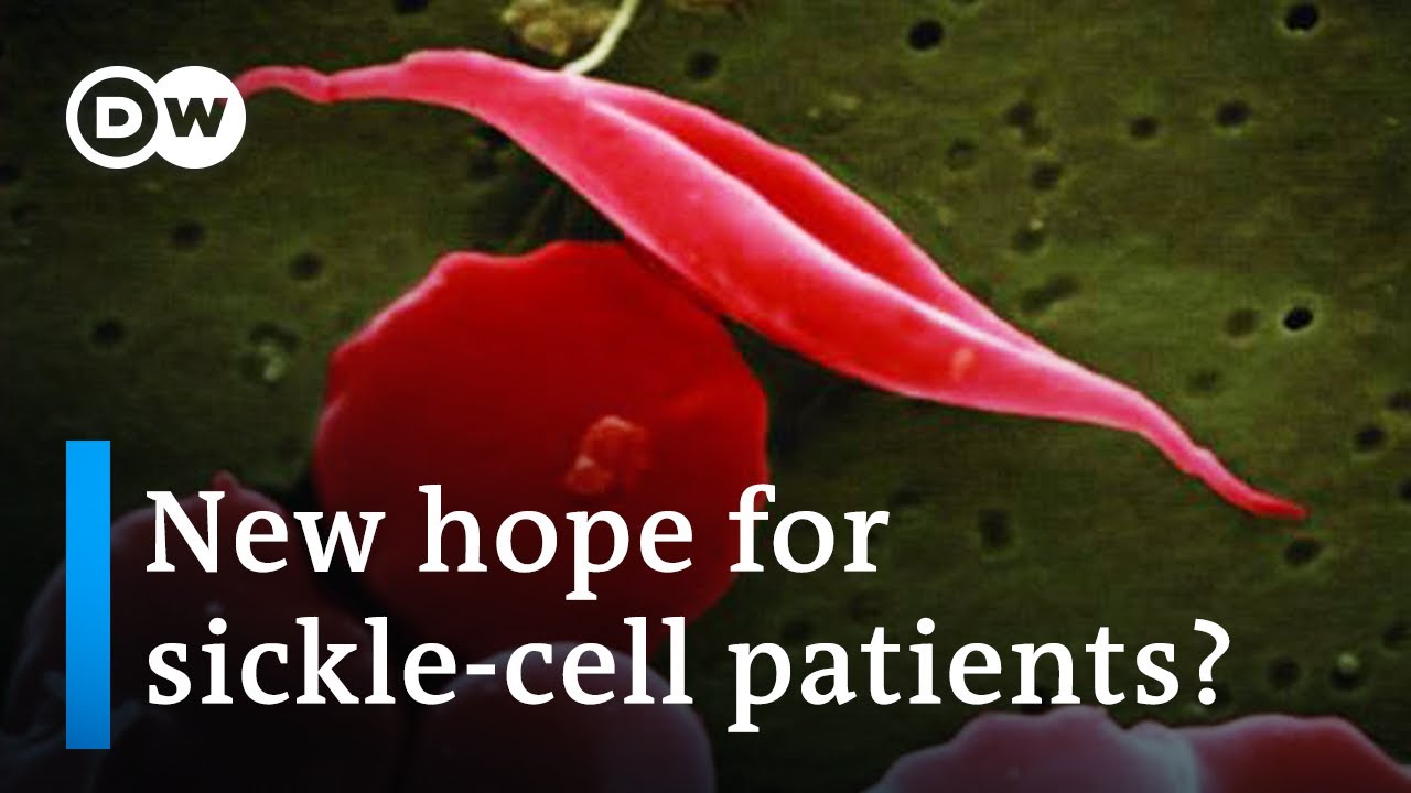 Could gene therapy be a gamechanger in the fight against sickle-cell anemia? | DW News