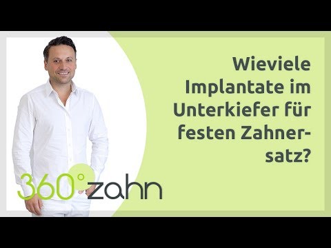 Wie viele Implantate im Unterkiefer für festen Zahnersatz? | Fragen & Antworten - 360°zahn