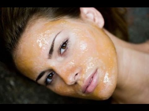Gente rimedio efficace da lentiggini Crema di risposte di cosmetici di corteccia da lentiggini