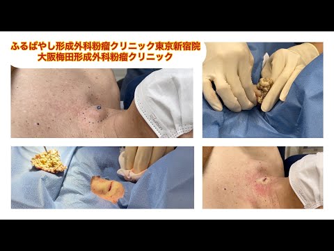 ブレグについて詳しく解説