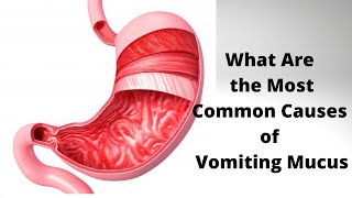 What Are the Most Common Causes of Vomiting Mucus